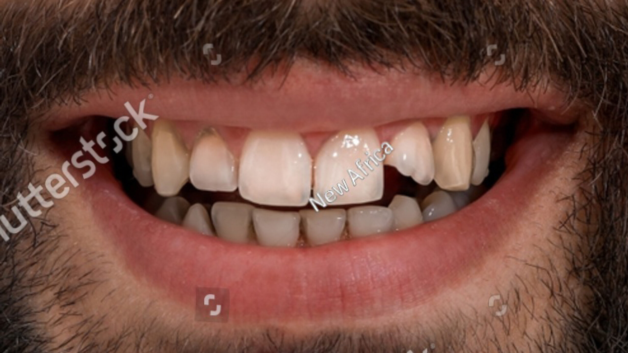 Smile_BeforeAfter_Examples_00