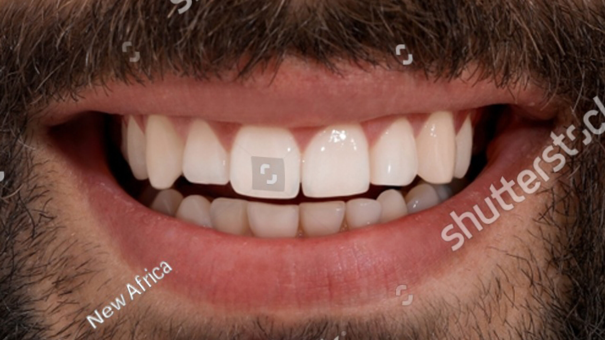 Smile_BeforeAfter_Examples_002
